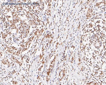 HUABIO ET7111-09 image 3