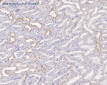 HUABIO ET7111-10 image 2