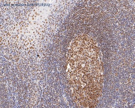 HUABIO ET7111-10 image 3