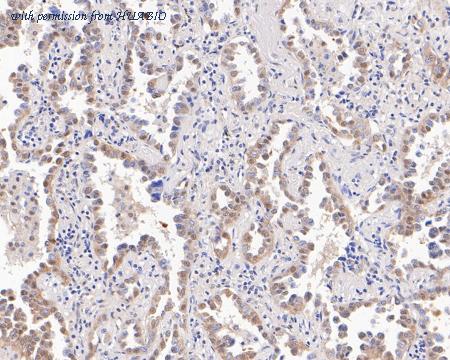 HUABIO ET7111-11 image 3