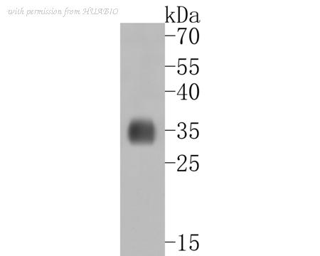 HUABIO ET7111-13 image 2