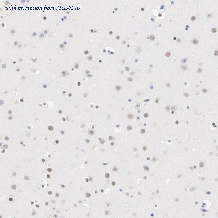 HUABIO ET7111-13 image 3