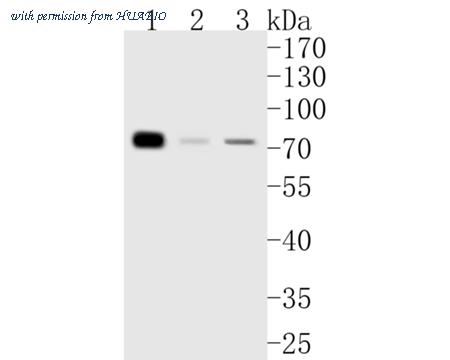 HUABIO ET7111-14 image 1
