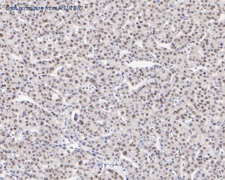 HUABIO ET7111-14 image 2