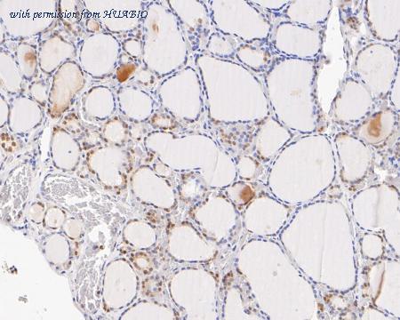 HUABIO ET7111-14 image 3