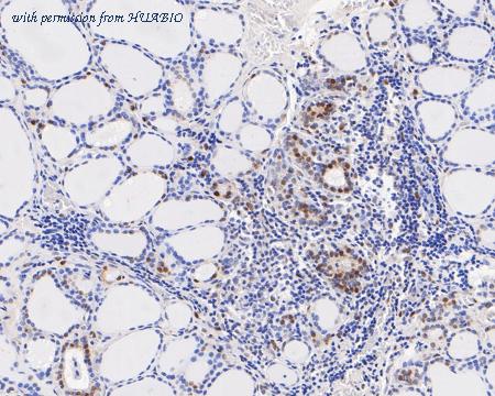 HUABIO ET7111-15 image 2