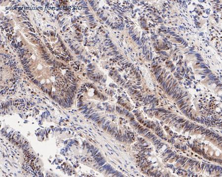 HUABIO ET7111-15 image 3