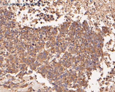 HUABIO HA500021 image 2