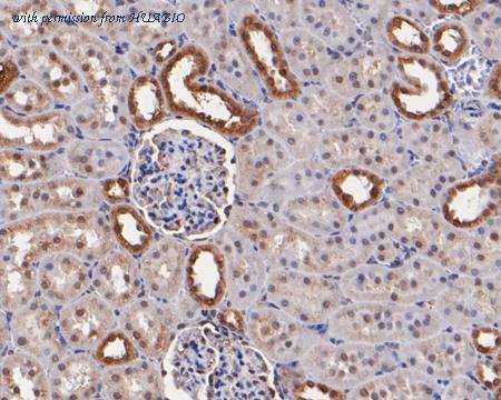 HUABIO HA500043 image 2