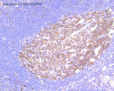 HUABIO HA500069 image 2