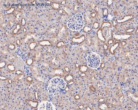 HUABIO HA500111 image 2