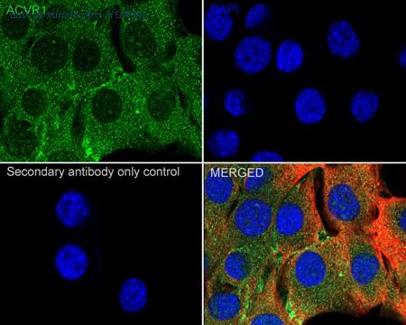 HUABIO HA500117 image 3