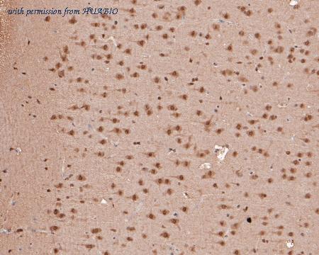 HUABIO HA500195 image 2