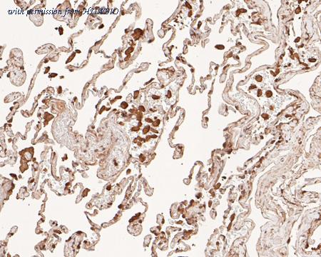 HUABIO HA500210 image 2