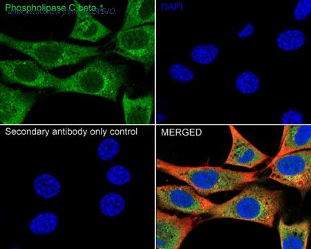 HUABIO HA500302 image 3