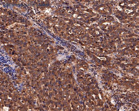 HUABIO HA500303 image 3