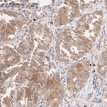 HUABIO HA500309 image 2