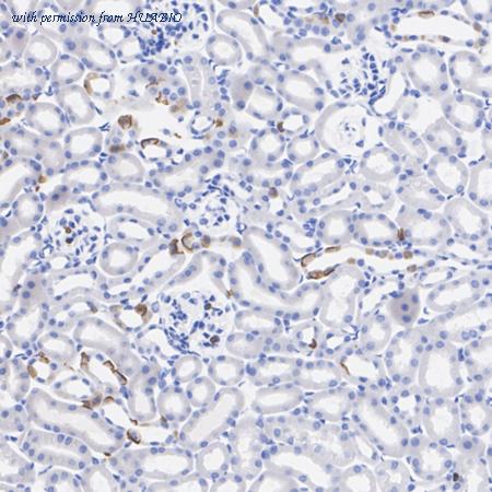 HUABIO HA500323 image 3