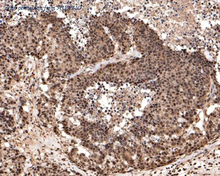 HUABIO HA500382 image 2