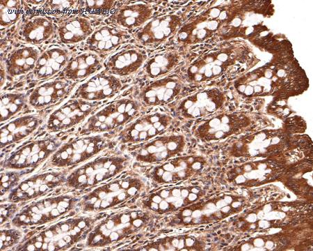 HUABIO HA500384 image 3