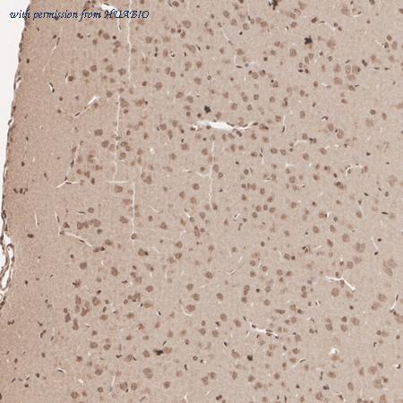 HUABIO HA500445 image 3