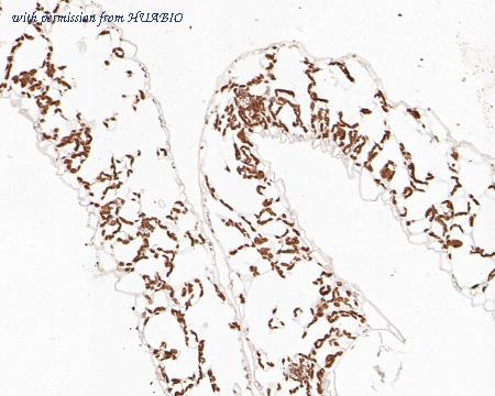 HUABIO HA500449 image 2