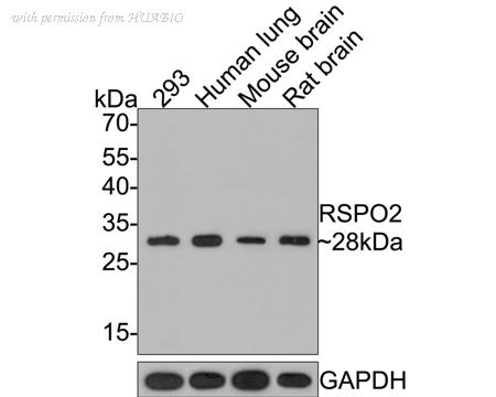 HUABIO HA500455 image 1