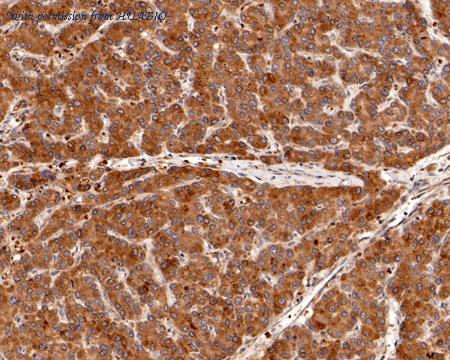 HUABIO HA500511 image 2