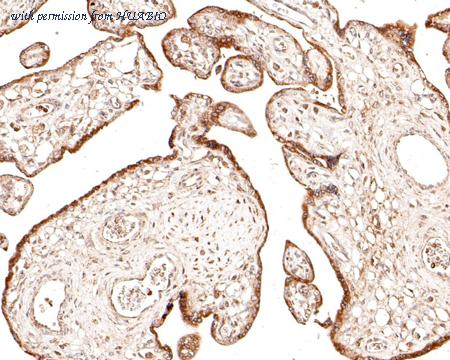 HUABIO HA500511 image 3