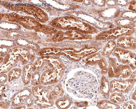 HUABIO HA600004 image 2