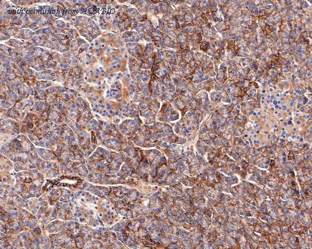 HUABIO HA600097 image 2