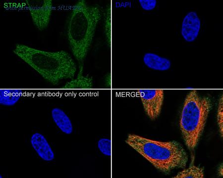 HUABIO HA601007 image 2