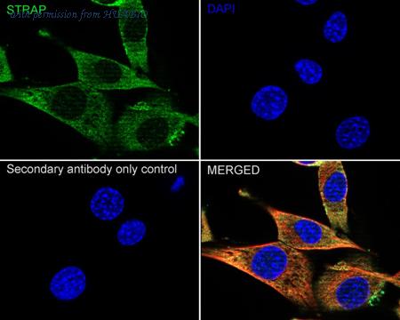 HUABIO HA601007 image 3