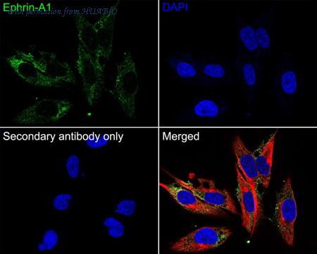 HUABIO HA601038 image 3