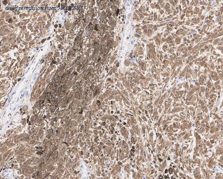 HUABIO HA601098 image 2