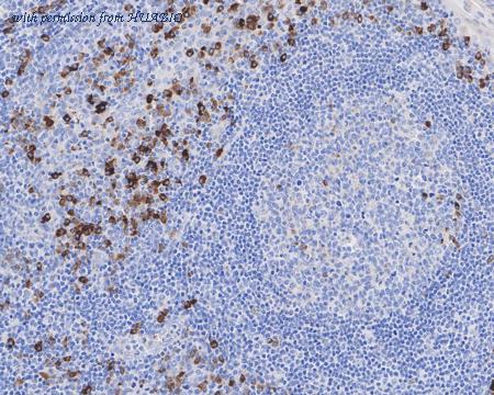 HUABIO HA601099 image 2