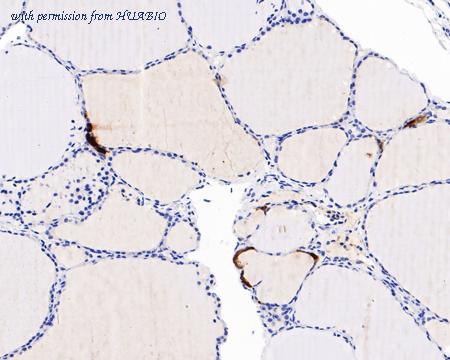 HUABIO HA601103 image 3