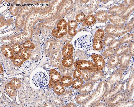 HUABIO HA601106 image 2