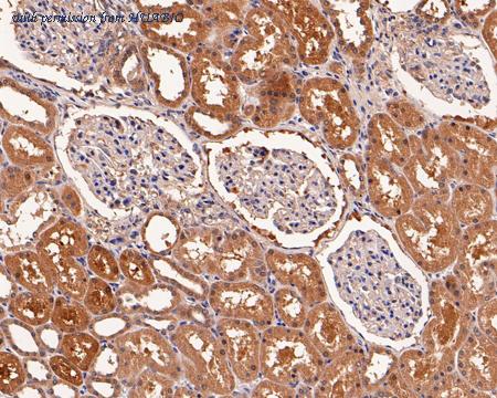 HUABIO HA601106 image 3