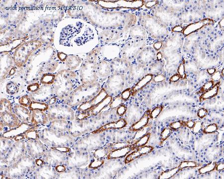 HUABIO HA601112 image 3