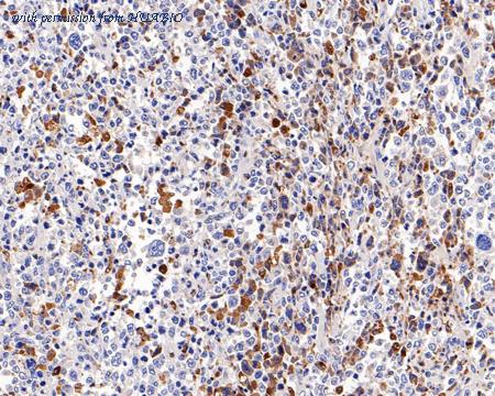 HUABIO HA601115 image 2