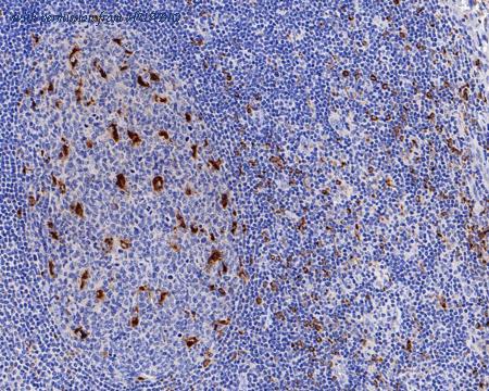 HUABIO HA601115 image 3