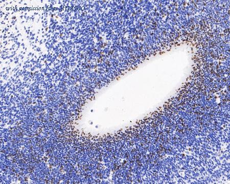 HUABIO HA601120 image 1