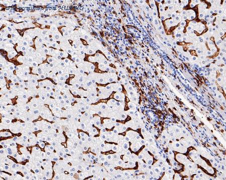 HUABIO HA601121 image 3