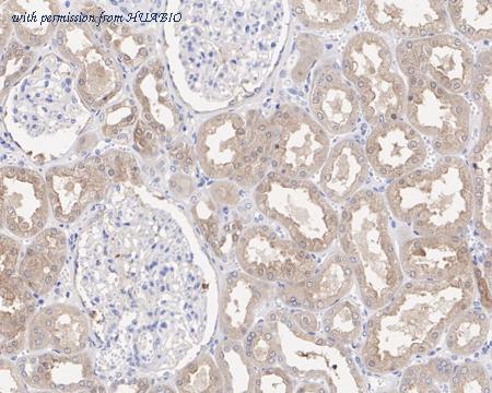 HUABIO HA601151 image 2