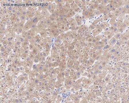 HUABIO HA601151 image 3