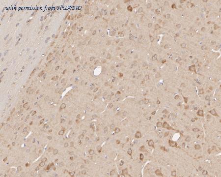 HUABIO HA601176 image 3