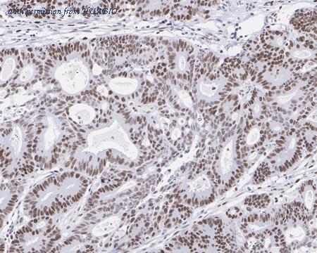 HUABIO HA601177 image 2