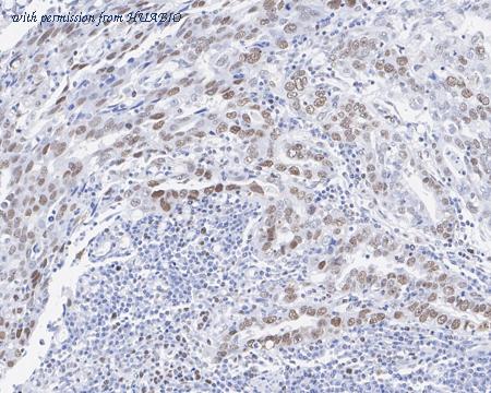 HUABIO HA601177 image 3