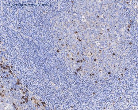 HUABIO HA601243 image 2